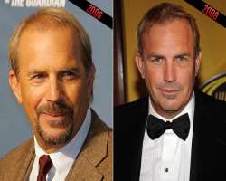 Kevin Costner before surgery